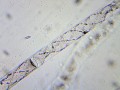 Mikroskop-delta-optical-biolight-300-z-kamerą-dlt-cam-2-mp-12.jpg